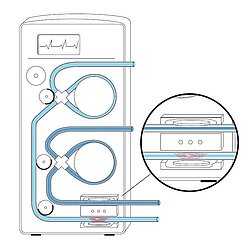 PI Illustration Dialyse